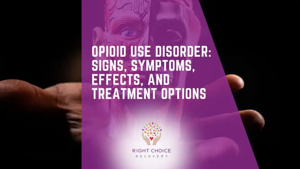 Opioid Use Disorder Signs Symptoms Effects Treatment