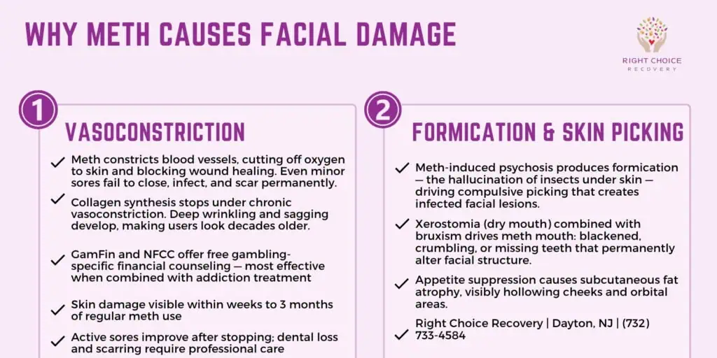 Why methamphetamine causes facial damage